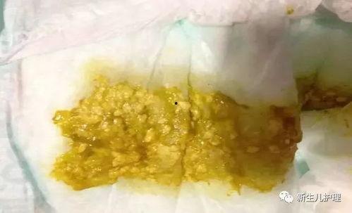 网红黑料牛奶秋刀鱼 过量吃瓜容易腹痛腹泻吗